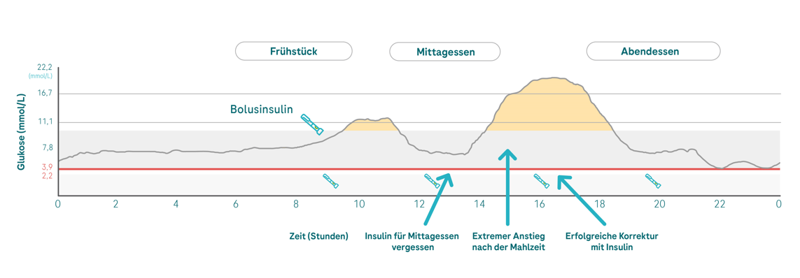 6.4.1 insulin forgotten mmol_G